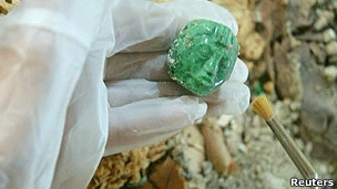 Los riesgos de la cirugía bariátrica