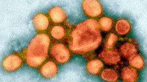 La gripe porcina mató a mucha más gente de lo pensado