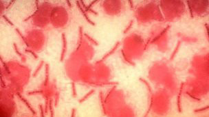 Más cerca de una vacuna contra el ántrax