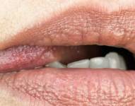 El contacto entre la boca y los genitales puede dar pie a infecciones.