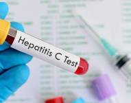 Unos 58 millones de personas en todo el mundo tienen hepatitis C.