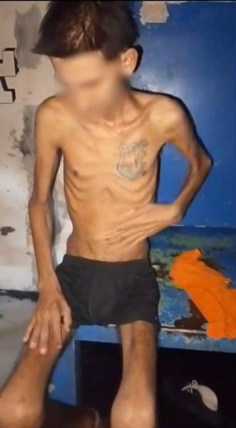 Reo con tuberculosis de la Penitenciaría del Litoral en Guayaquil.