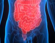 Intestino y colonDONALD WEITZ/FLICKER (Foto de ARCHIVO)1/1/1970