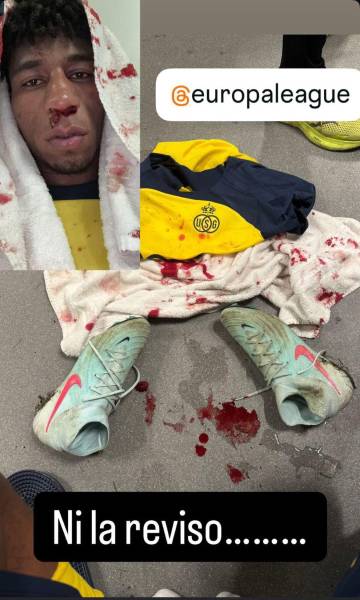 Kevin Rodríguez recibió un fuerte golpe y terminó ensangrentado en la Europa League