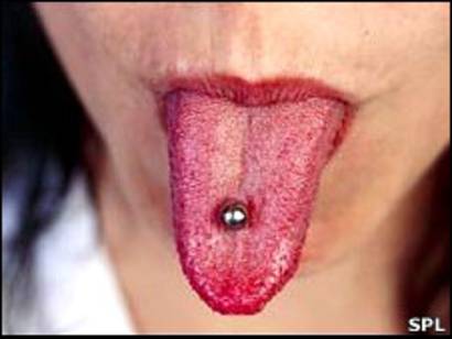 El piercing de la lengua puede dañar los dientes