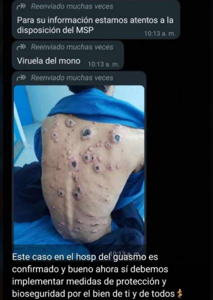 Imagen desmentida por la Federación Médica Ecuatoriana y el Ministerio de Salud Pública (MSP).