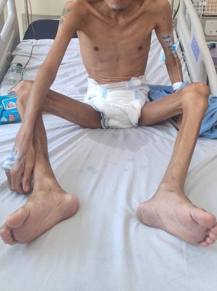 Los reos que llegan a ser trasladados a hospitales públicos llegan con signos de desnutrición crónica.