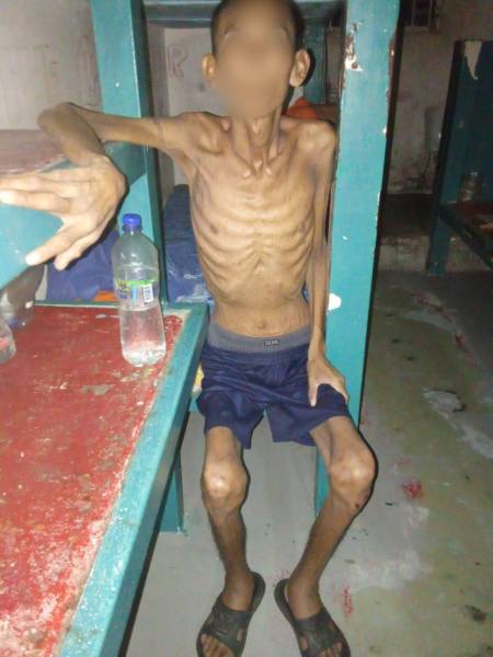 Reo con tuberculosis de la Penitenciaría del Litoral en Guayaquil.