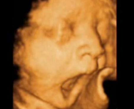 Confirman que los fetos bostezan en el útero