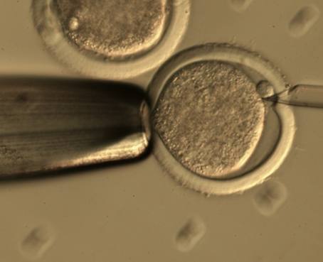 Alemania da luz verde a las pruebas genéticas de embriones in vitro