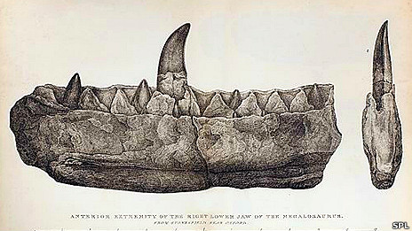 Los riesgos de la cirugía bariátrica