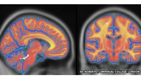 Confirmado: la fuerza del karate está en la mente, no en el músculo