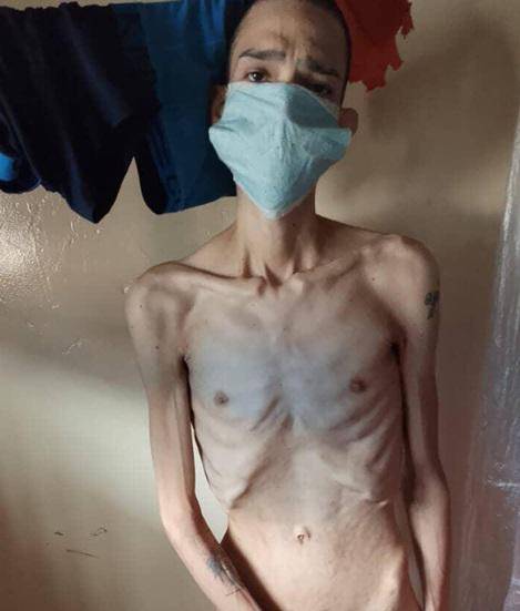 La tuberculosis es una de las principales enfermedades que ha causado la muerte de decenas de presos en la Penitenciaría del Litoral