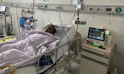 Murió en China uno de los médicos cuya piel se oscureció tras contraer coronavirus