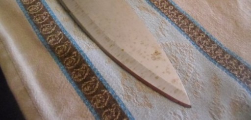 Médicos retiran un cuchillo clavado en la cabeza de un campesino brasileño