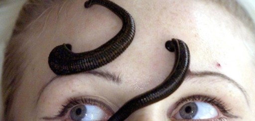 Los tratamientos de belleza más insólitos y extremos de las famosas