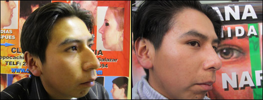 Campaña incita a los bolivianos a operarse la nariz