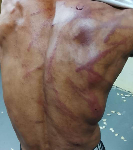 Según los familiares, las marcas en la espalda de este preso habrían sido provocadas por los militares durante operativos en la Penitenciaría del Litoral.