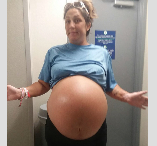 Récord de un nacimiento en Florida: Mujer da a luz a un bebé de 13 libras