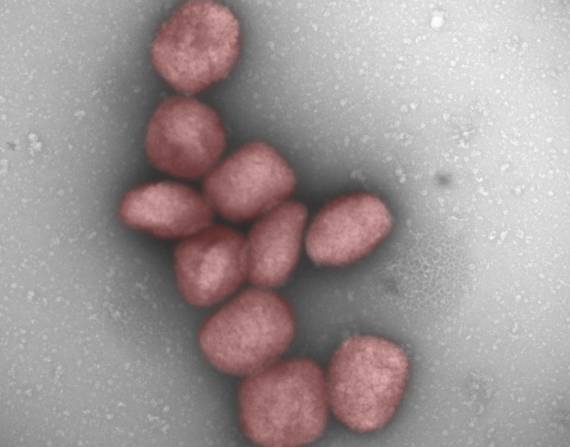 Partículas del virus de la viruela del mono teñidas de rojo en una fotografía facilitada por el Centro de Biología Molecular Severo Ochoa. EFE