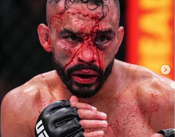 Chito Vera lastimó en varias ocasiones el rostro de Rob Font con contundentes codazos y patadas, que lo terminaron cortando de manera profunda.