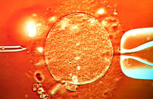 El esperma del donante se utilizó en clínicas de toda Europa (imagen de archivo).