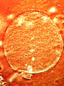 El esperma del donante se utilizó en clínicas de toda Europa (imagen de archivo).