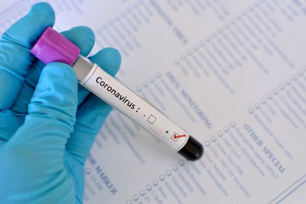 Científicos peruanos crean prueba para detectar COVID-19 en 40 minutos