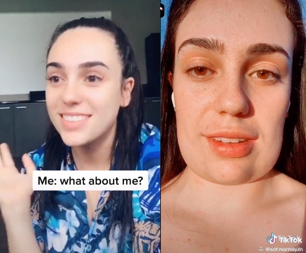 Joven se hizo tratamiento estético que dejó su rostro cuadrado