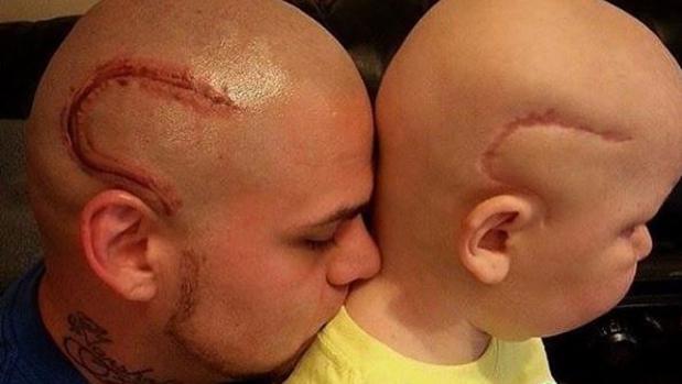 Un hombre se tatuó la cicatriz de su hijo y conmueve las redes