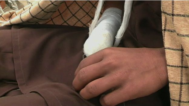 El niño que se amputó la mano por "blasfemar" contra Mahoma