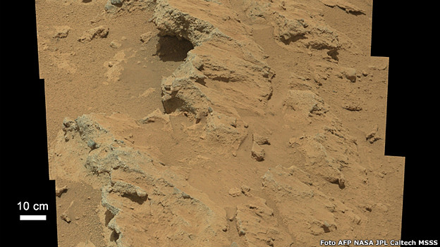 Los riesgos de la cirugía bariátrica