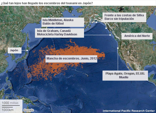 Los riesgos de la cirugía bariátrica