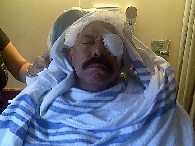 Oscar D&#039;León perdió la visión en su ojo izquierdo