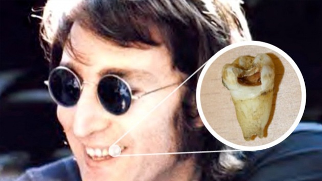 Fan compró una muela de Jhon Lennon y planea clonarlo