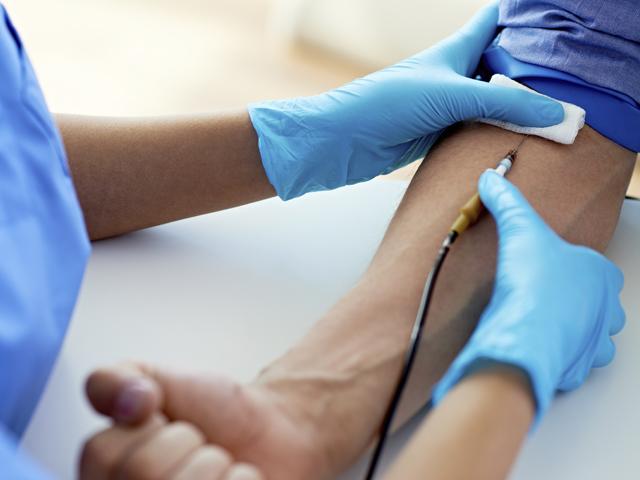 Análisis de sangre y saliva para detectar los cánceres de cabeza y cuello