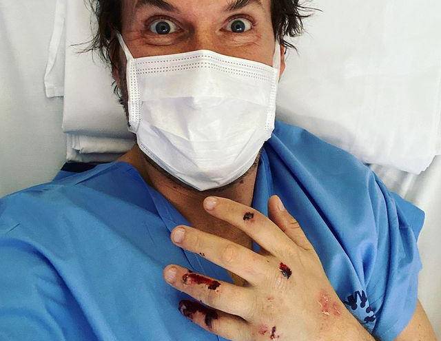 Imagen compartida por Andrés Parra con respecto a su accidente.