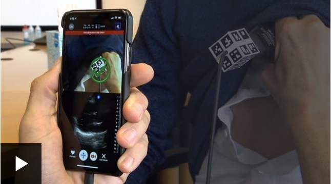 Así funciona el escáner de bolsillo que puedes usar con tu celular