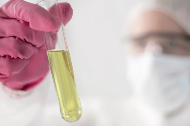 Lo que el color de tu orina dice sobre tu salud