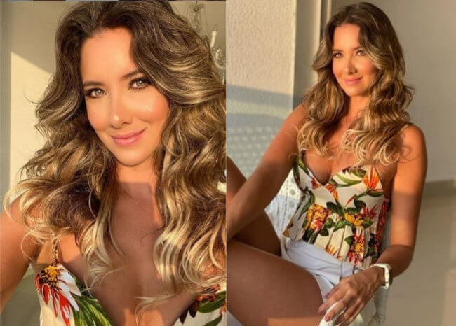 Ex Miss Colombia muestra la amputación de su pierna