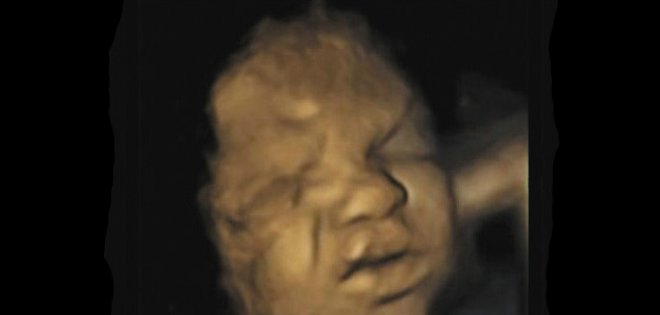 Los fetos practican el llanto en el útero