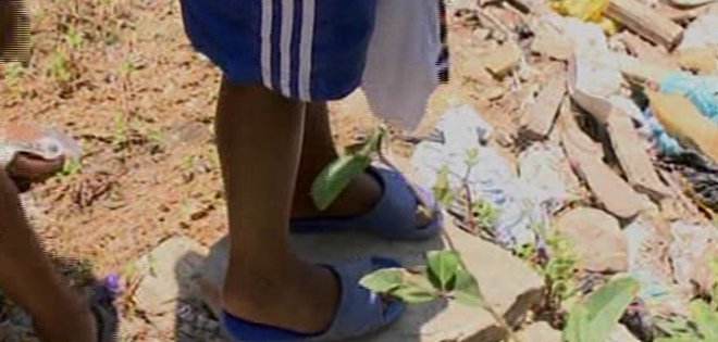 Guayaquil: Madre quemó con agua caliente los pies de su hijo de 10 años