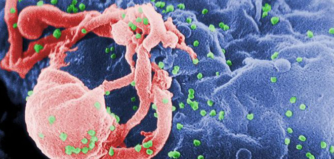 Consiguen controlar la infección por VIH con terapia genética