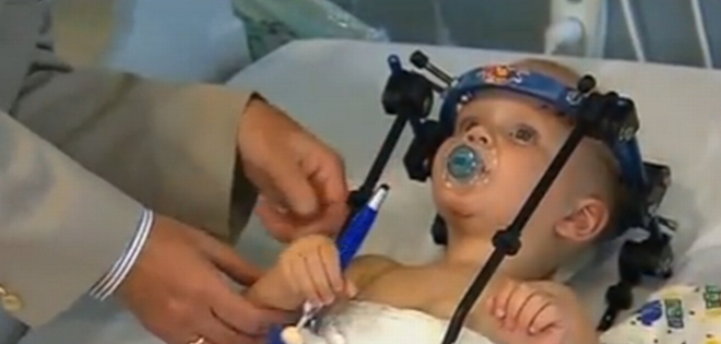 Médicos australianos salvan la vida a niño decapitado