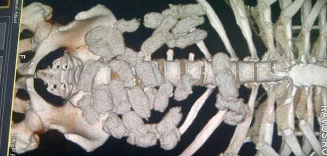 Guayaquil: crece el número de detenidos por ser "mulas del narcotráfico"