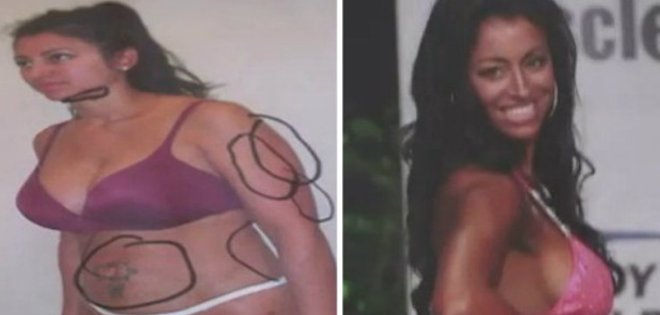 Cirujano plástico “esculpe” a la mujer ideal y se casa con ella