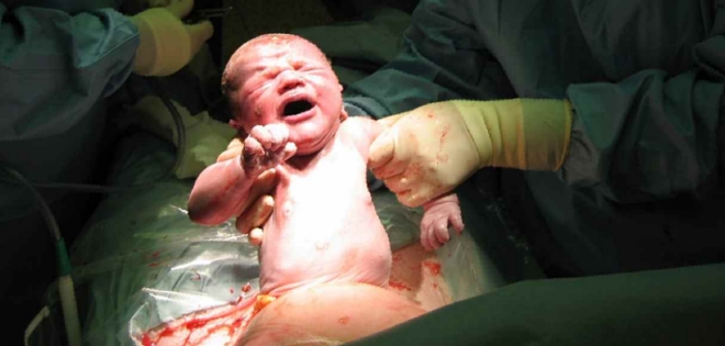 Brasil fomenta parto natural contra la &quot;epidemia&quot; de las cesáreas