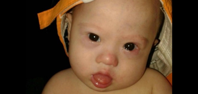 Pareja australiana abandona bebé con síndrome de Down de madre subrogada