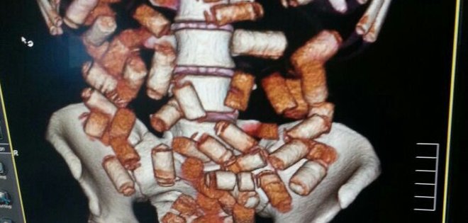 Guayaquil: crece el número de detenidos por ser "mulas del narcotráfico"