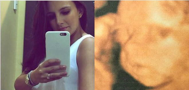 Estéfani Espín habla sobre la hermosa experiencia de vivir su embarazo